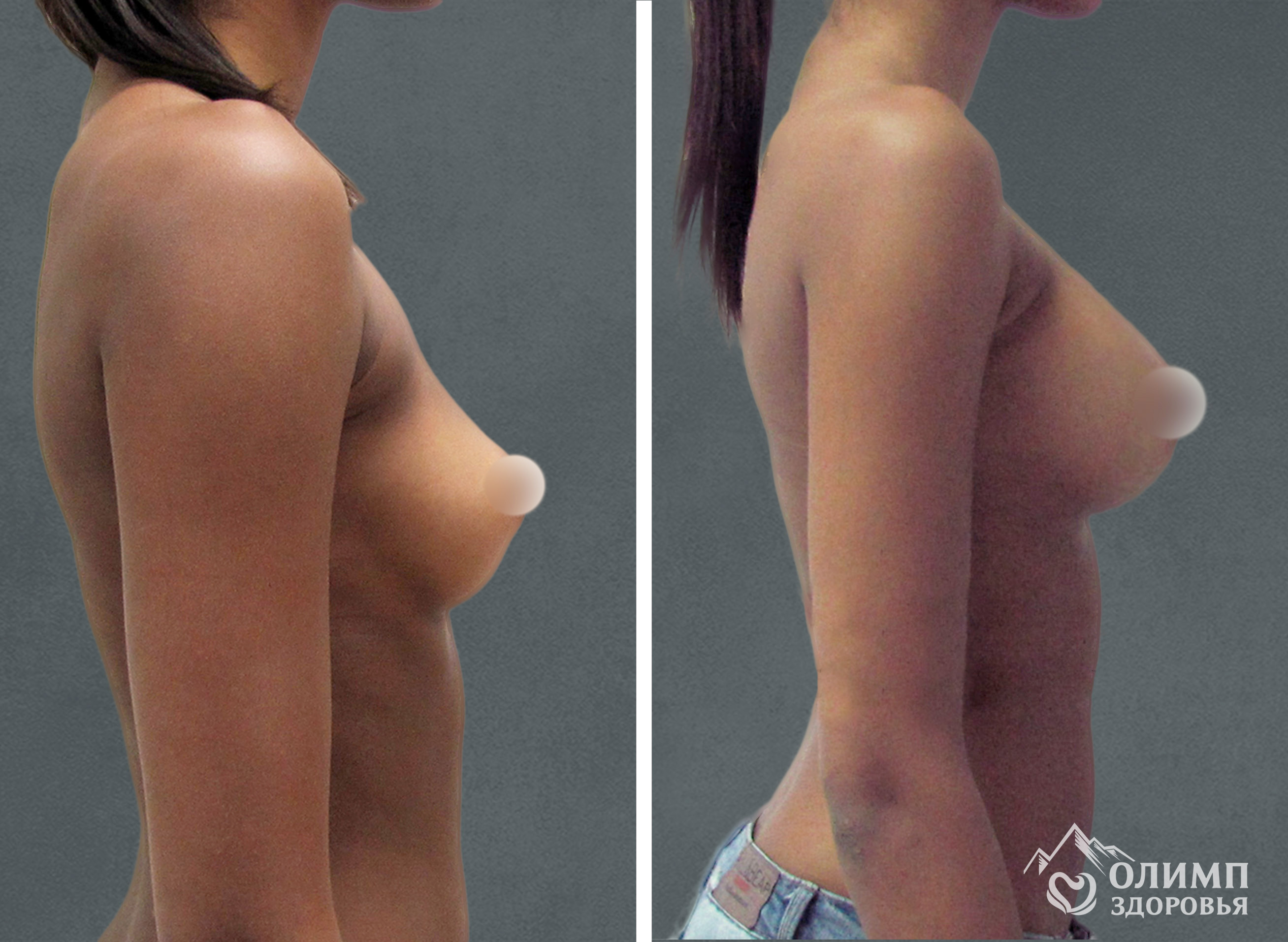 увеличивается грудь с возрастом у женщин фото 65